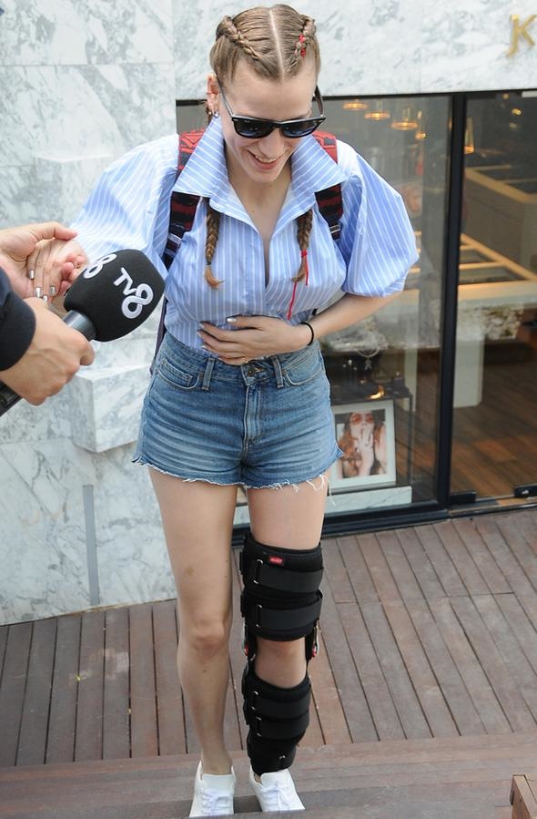 Serenay Sarıkaya'nın bacağına ne oldu?